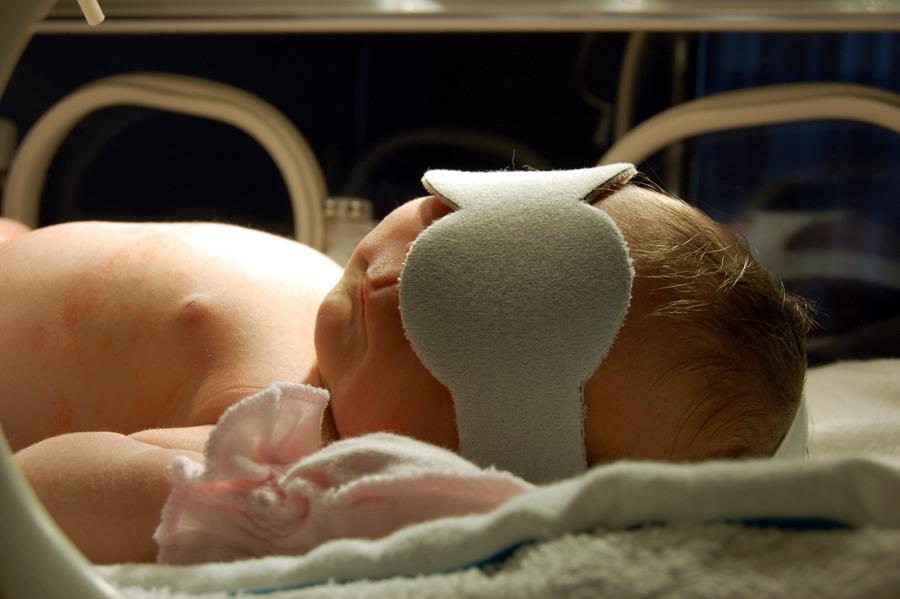 Hoe baby's leren zien na vroege blindheid