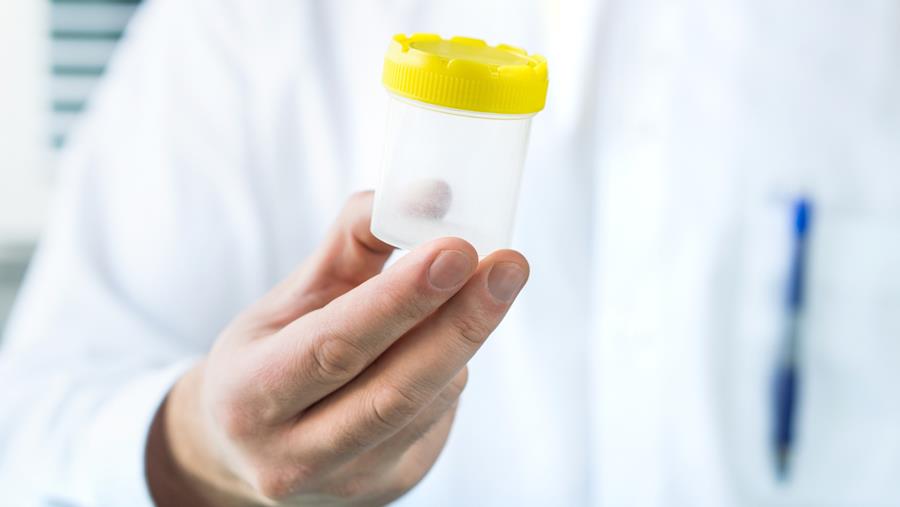 Deense donor met ernstige genetische afwijking verwekt 197 kinderen in Europa